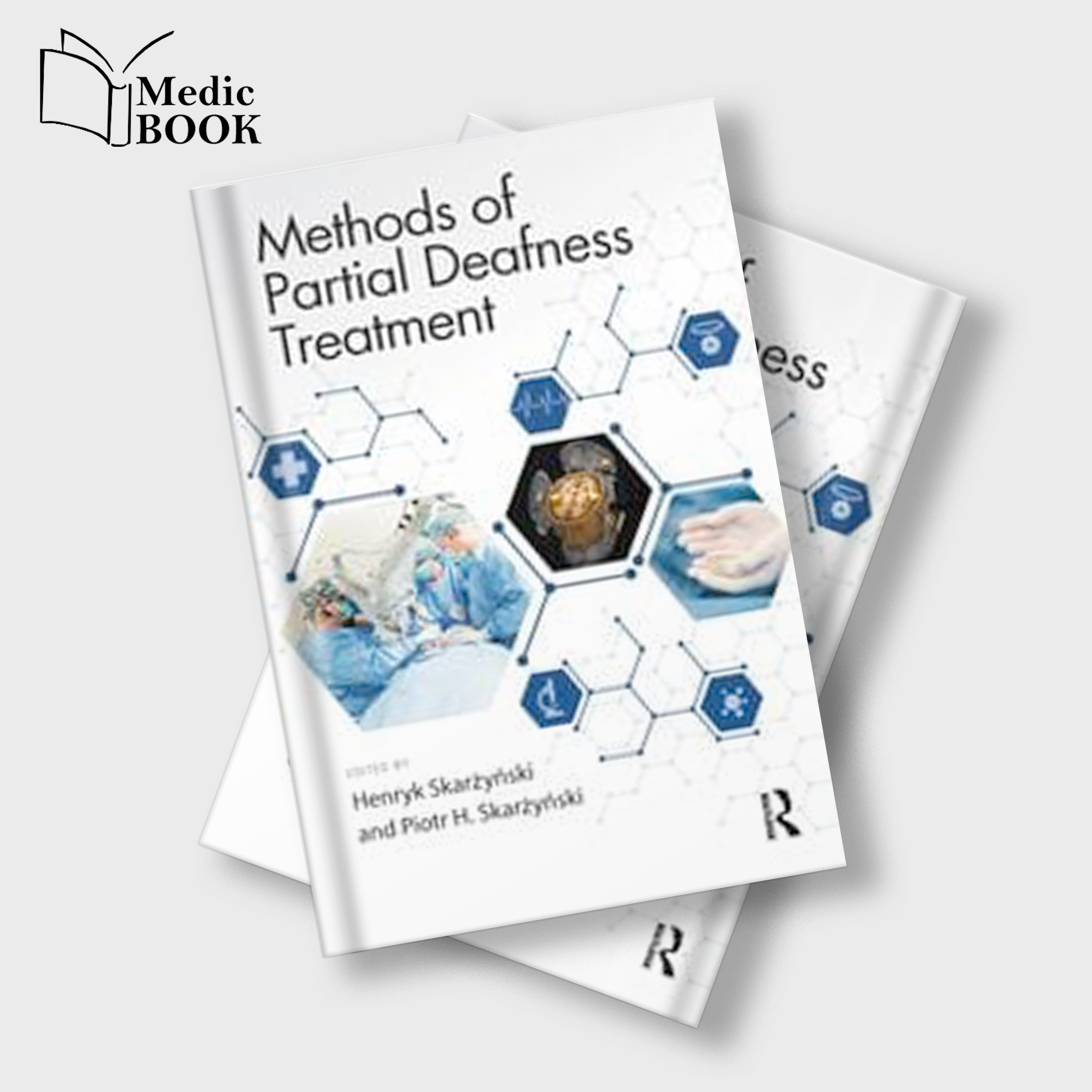 Methods-of-Partial-Deafness-Treatment-(Original-PDF-from-Publisher) Methods of Partial Deafness Treatment (Original PDF from Publisher)